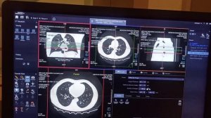 How to perform sagital coronal and axial on siemens helthiness somatom go.up #siemensct.