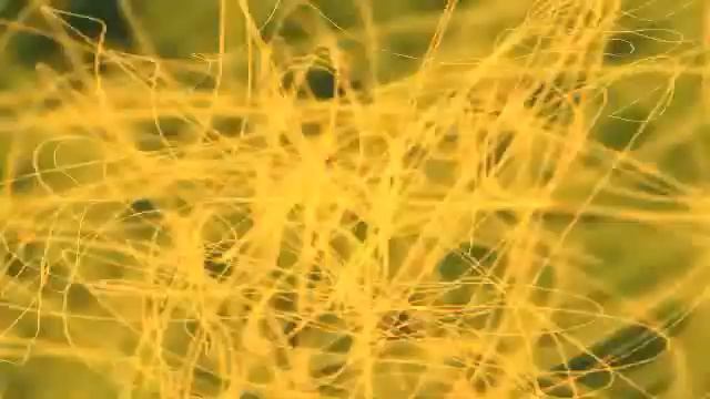 Aaron Static - Severance смотреть онлайн