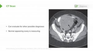 3.11 Ovarian Torsion- Examination & Management