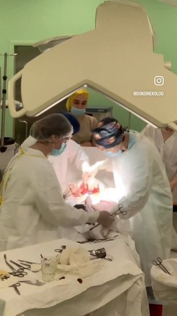 Кесарево сечение. крупный плод. смотреть онлайн