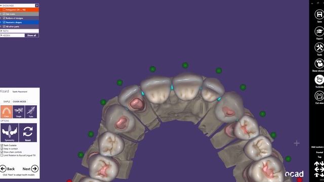 exocad Quick Guide The 'Chain Mode' Feature смотреть онлайн