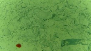 Растворение сахара в воде под микроскопом. Dissolving sugar in water under a microscope.