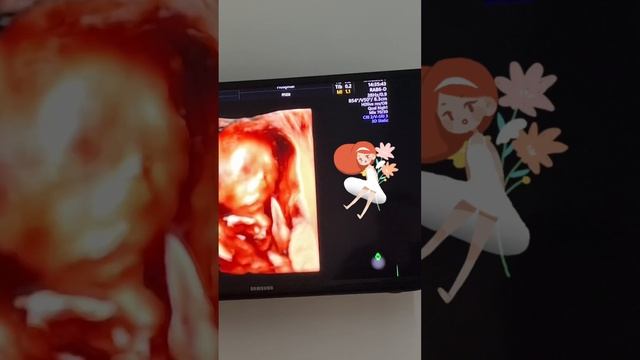 Наша доча. Сборник УЗИ смотреть онлайн