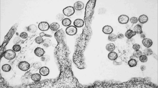 complete details of hantavirus | what is hantavirus | how to start hantavirus | new virus in china