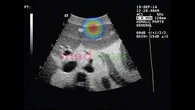 Siemens Acuson Aspen - 4c1 - głowica USG смотреть онлайн