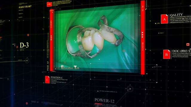 Превью кейса фиксация края перфорации 26 K-файлами #DET.expert Boosty.to #DTGC 0020 4K смотреть онлайн