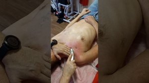 РЕАБИЛИТАЦИЯ УЧАСТНИКА СВО ПОСЛЕ РАНЕНИЯ, УСТРАНЕНИЕ СПАЕК В МЯГКИХ ТКАНЯХ
