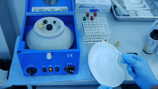 Leukocyte esterase test on synovial fluid смотреть онлайн