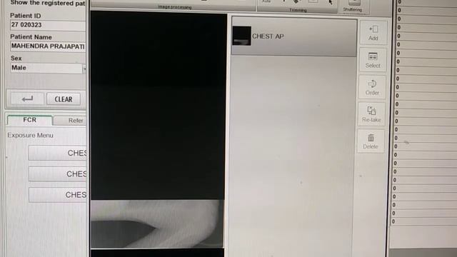 FCR Prima Console Image Works CR, How to use Fuji FCR (X Ray?) смотреть онлайн