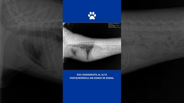 Nala. Soplo cardíaco continuo grado VI/VI смотреть онлайн