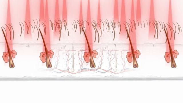 The benefits of Capillus272® Laser Cap for hair loss смотреть онлайн