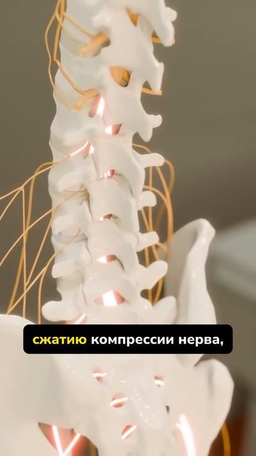 Поясница и боль в колене. Ссылка на программы для реабилитации в описании профиля #больвколене