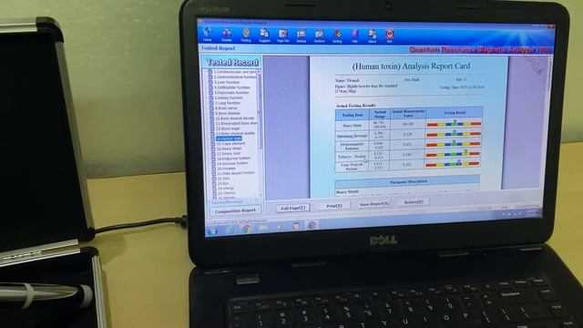 8th Generation - क्वांटम एनालाइजर मशीन कि रिपोर्ट्स पढ़ना सींखे ( Part 2) смотреть онлайн