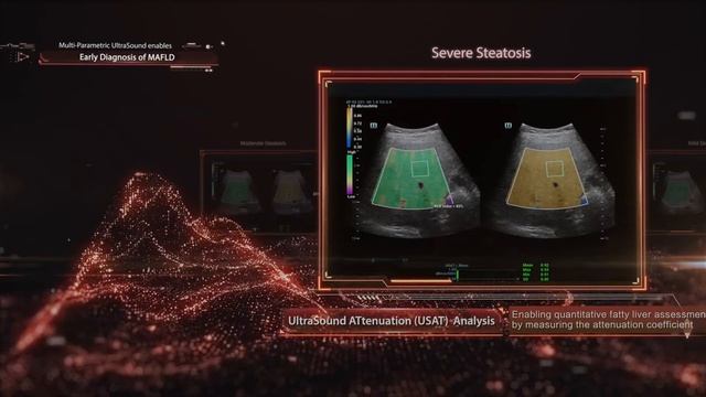 Новый скачок в области ультразвука: Platinum Edition Resona R9 смотреть онлайн