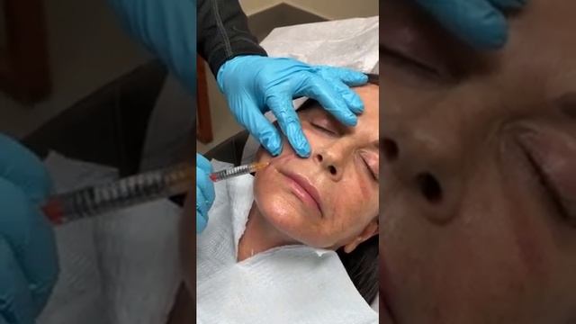 RHA Collection Of Injectables Now Available In South Florida смотреть онлайн