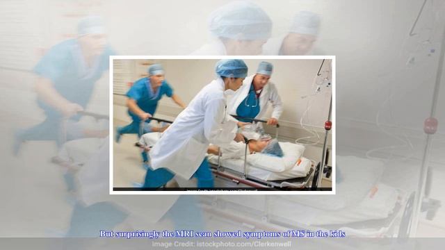 [Chanel News] Mri scans could help in detecting multiple sclerosis in kids смотреть онлайн