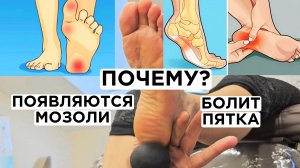 Почему начинают болеть пятки и появляются мозоли. Как убрать?