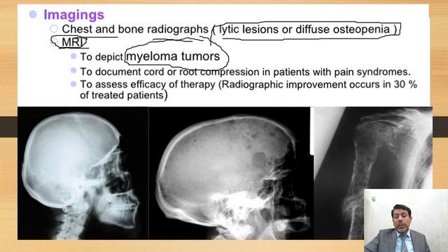 MM4 смотреть онлайн