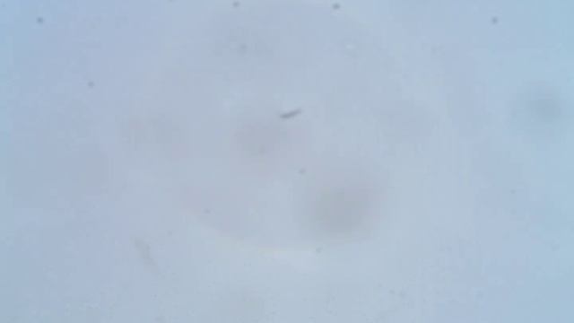 лужа под микроскопом смотреть онлайн