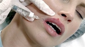 Novacutan FBio Lips Dr. Matveeva