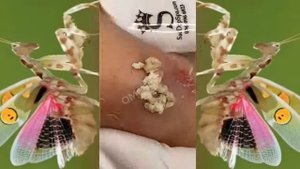 Relax squeezing out blackheads #37 Черные точки