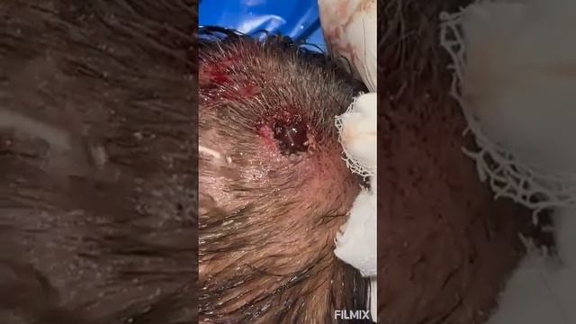 Handling maggots in an old wound смотреть онлайн