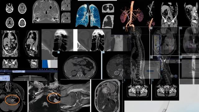 Siemens SOMATOM Scope смотреть онлайн