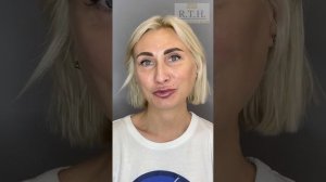 Блефаропластика и Булхорн в Москве отзыв. Пластика в Москве Real Trans Hair