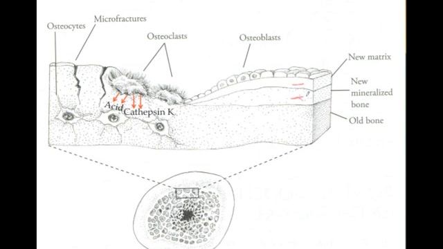 Understanding the Natural Approach to Osteoporosis - Part 1 смотреть онлайн