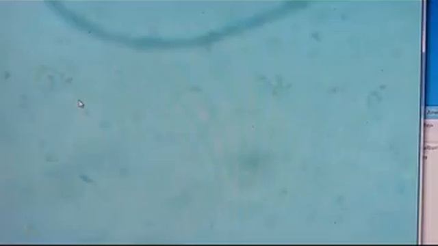 Mikroskop Bresser Biolux badanie żywej kropli krwi 2 смотреть онлайн