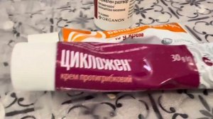 Себорея . Себорейный дерматит .Я не в лучшем виде. ЛЕЧЕНИЕ! #себорея