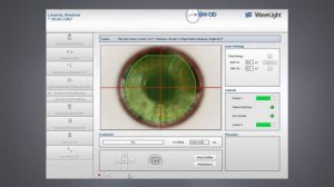 WaveLight Refractive Suite from Alcon