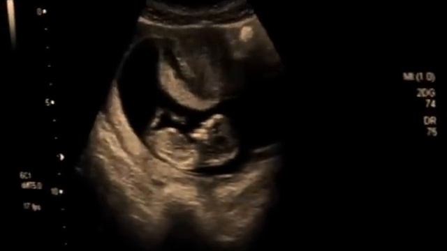 Un milagro llegó a nuestras vidas // Familia: Lira Méndez смотреть онлайн