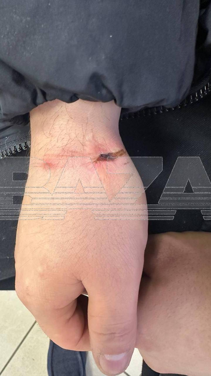МАГМЕД МАГАМЕДОВ обвинил трёх сотрудников полиции в пытках !!!