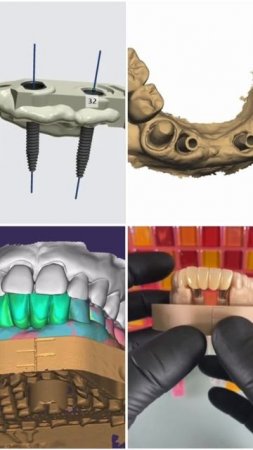 Digital dentistry