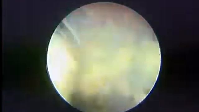 VPlus Procedimiento y piezas de mano смотреть онлайн