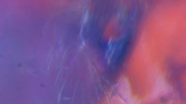 Мучной жук под микроскопом смотреть онлайн