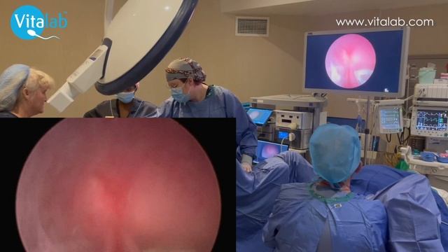 Dr Gobetz discusses the dangers of performing a blind D&C and what patients should know смотреть онлайн