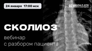 Вебинар СКОЛИОЗ с врачом Александром Атякшевым
Эфир от 24 января 2025 г.