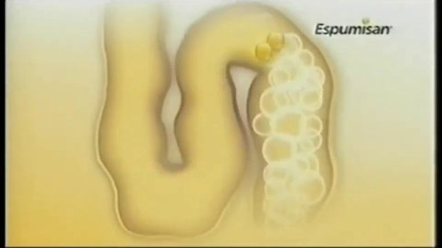 Reklama Espumisan z 2012-2015 смотреть онлайн