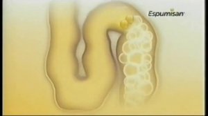 Reklama Espumisan z 2012-2015