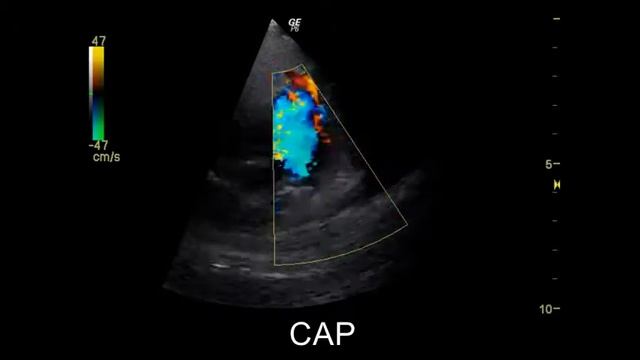 Conducto Arterioso Persistente perro con hipertensión pulmonar смотреть онлайн