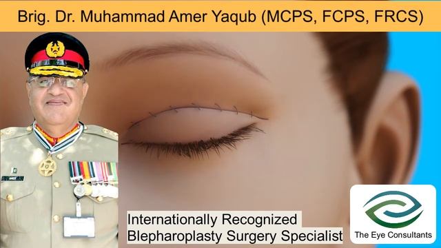 Best Oculoplastic Surgeon in Pakistan  Brig. Dr. Muhammad Amer Yaqub  The Eye Consultants