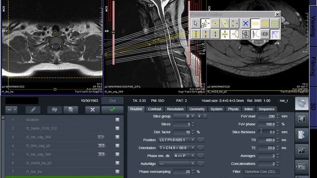 Syngo MRI Protocol cards смотреть онлайн