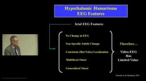 Hypothalamic Hamartoma: The Syndrome of Hypothalamic Hamartoma by John F. Kerrigan