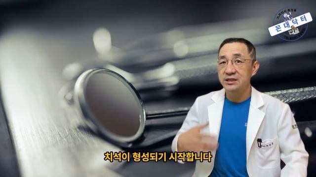 치석은 치과의사에겐 황금알을 낳는 거위는 아니어도 화수분까지는 되는 듯 #치석제거 #스케일링 #치석 #치과의사