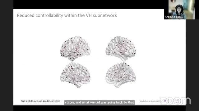 #CNStalk: Finding the network balance in Parkinson’s hallucinations - Angeliki Zarkali