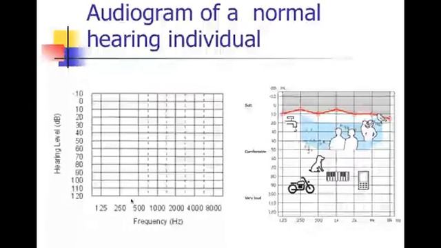 CDIS 4027 Introduction to the Decibel Pt. 2 смотреть онлайн
