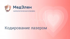 Кодирование лазером