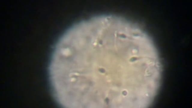 Sperma unter dem Mikroskop смотреть онлайн